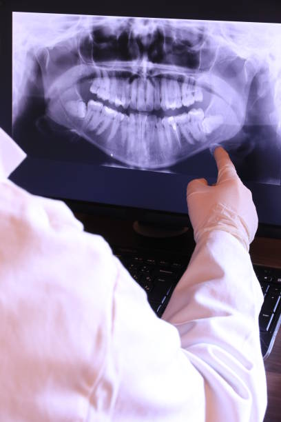 Best Teeth Whitening  in Venice, FL